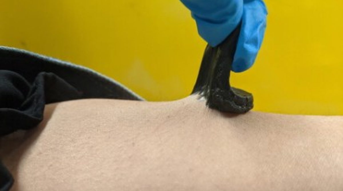 Hydrogel kết hợp graphene giúp cải tiến cảm biến sinh học đeo được