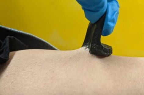 Hydrogel kết hợp graphene giúp cải tiến cảm biến sinh học đeo được